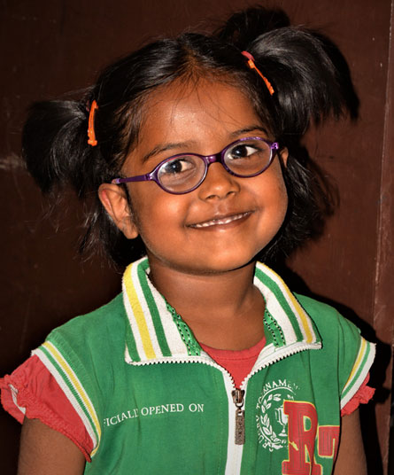 Squint can be treated at a very early age - Aarushi Story